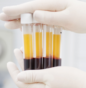 Lidkorrektur, Tränensäcke, Hängelider, Augenringe, Minilft, Facelift, Gesichtsstraffung, Halslift, Halsfalten, Hyaluronsäure, Botox, Migräne, Falten, Schwitzen